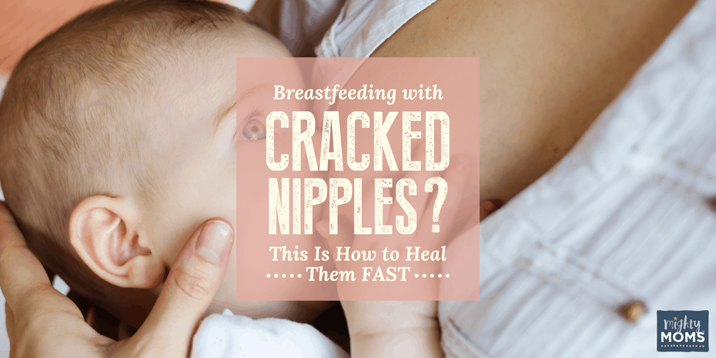 What are Damaged Nipples, and What does that Mean? — Genuine Lactation